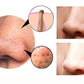 4 in 1 Body Guasha Cupping Blackhead Remover Machine